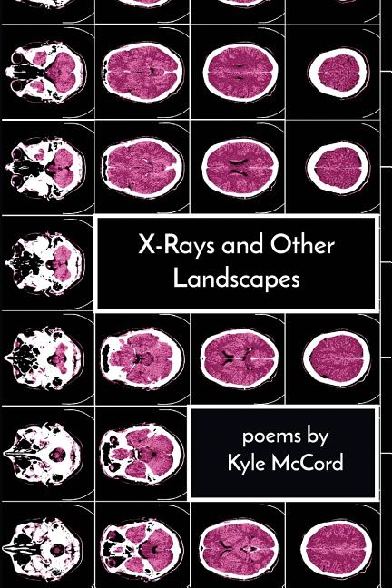 X - Rays and Other Landscapes - GetBooks_book - The Poetry Shop